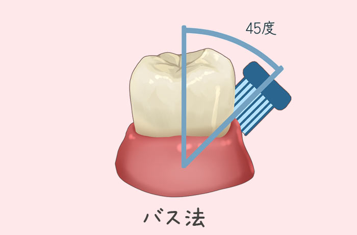 バス法による歯磨き方法の図解(歯ブラシを45度に充てて歯周ポケットを清掃)